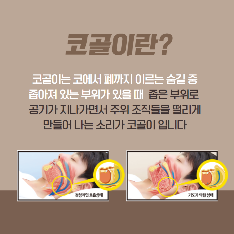 [수원 수면클리닉] 매일같이 졸음이 몰려온다면! (2/10)