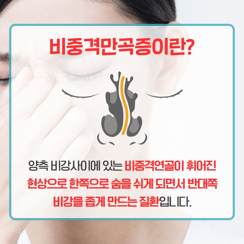 휜 코, 외모만의 문제일까? (2/10)
