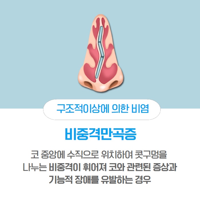 [수원 이비인후과] 콧물이 나는 이유 감기가 아닐 수도. (4/14)
