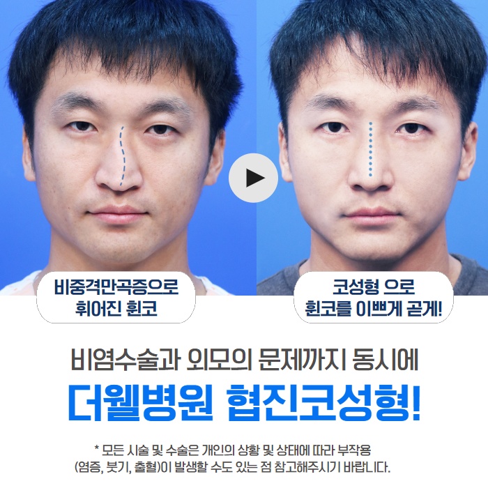 [수원 이비인후과] 콧물이 나는 이유 감기가 아닐 수도. (11/14)