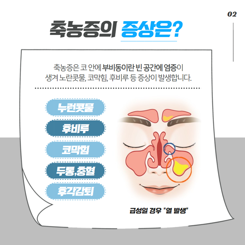 축농증(부비동염)은 왜 생길까? 원인과 치료! (3/8)
