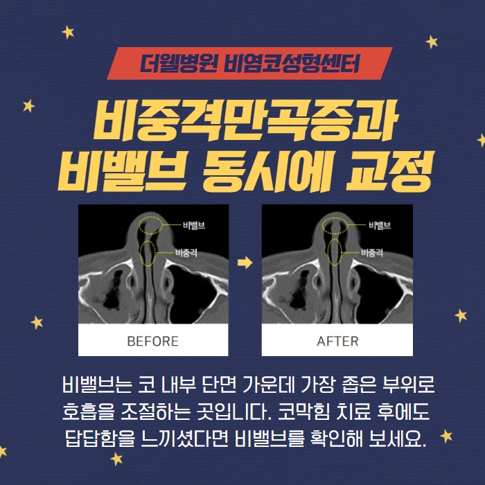 실비보험 혜택 받아 비염 치료 코성형 동시에 할 수 있다! 협진코성형 (4/9)