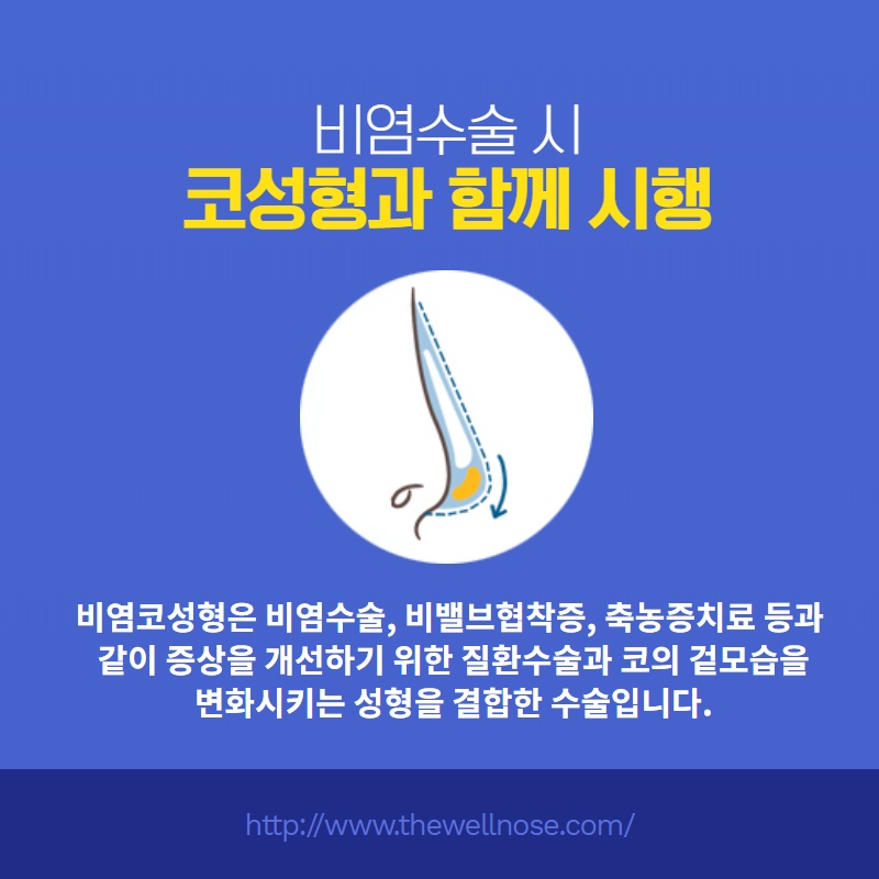 비중격만곡증치료와 코성형을 동시에, 원인과 치료 방법 (4/11)