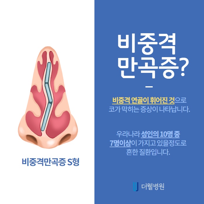 숨을 쉬기가 힘들어요! 비중격 만곡증이란? (2/10)