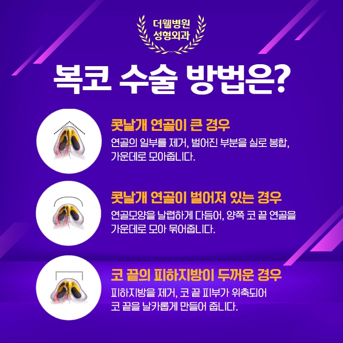 둥글고 뭉특한 코를 오똑하게! 복코성형 (4/9)