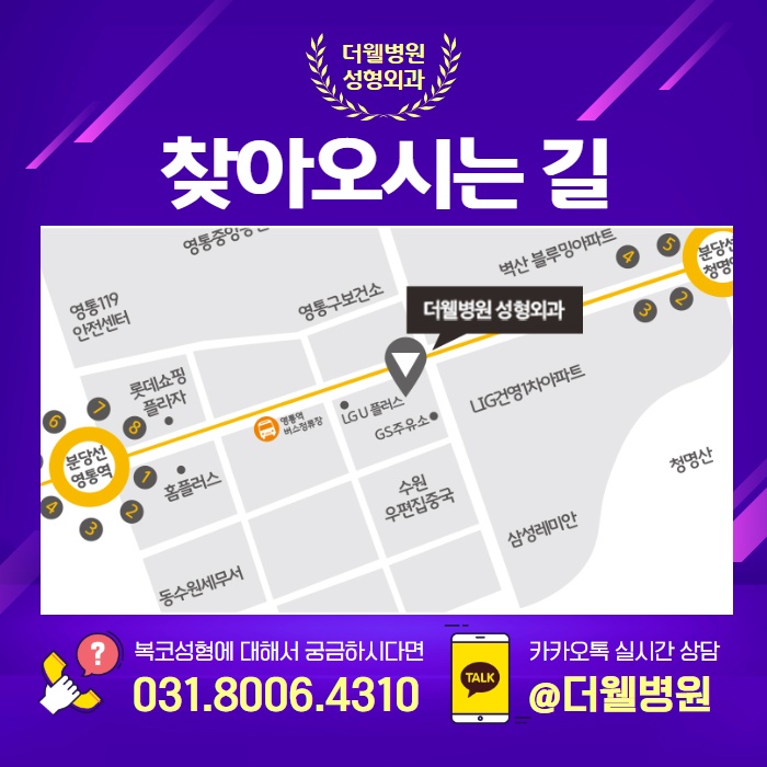 둥글고 뭉특한 코를 오똑하게! 복코성형 (8/9)