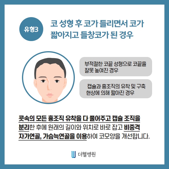 유형별 코재수술 (5/10)