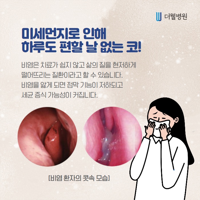 미세먼지로 힘든 코, 하루 한번 코세척 (2/10)