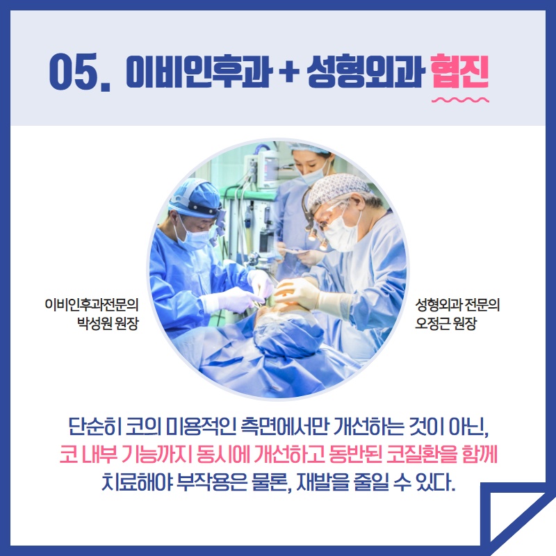휘어진 코 성형 수술 (6/9)