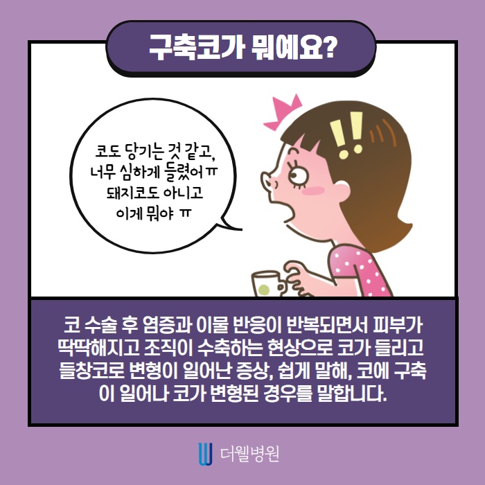 코 재수술 키포인트는? (3/10)