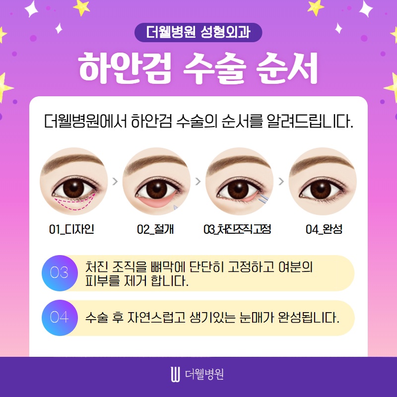 노화의 시작! 눈 밑 처짐! (5/10)