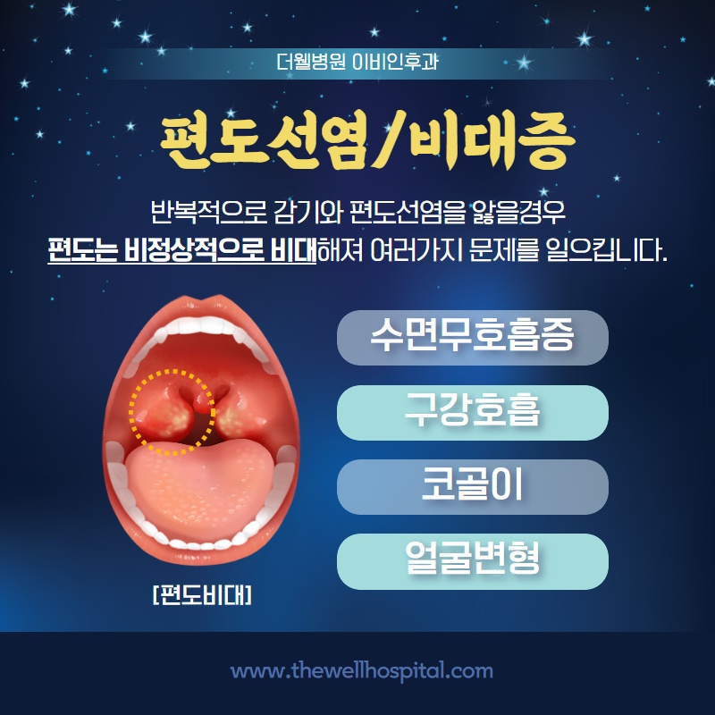 건조한 겨울에 더 붓고 아픈 편도선! (4/9)