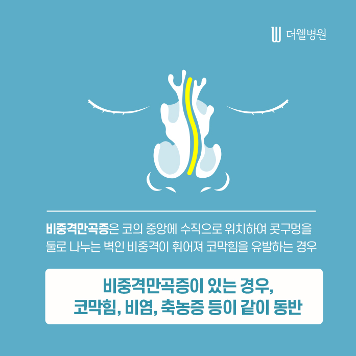 두통, 안면통의 원인 제대로 알아보기! (2/13)