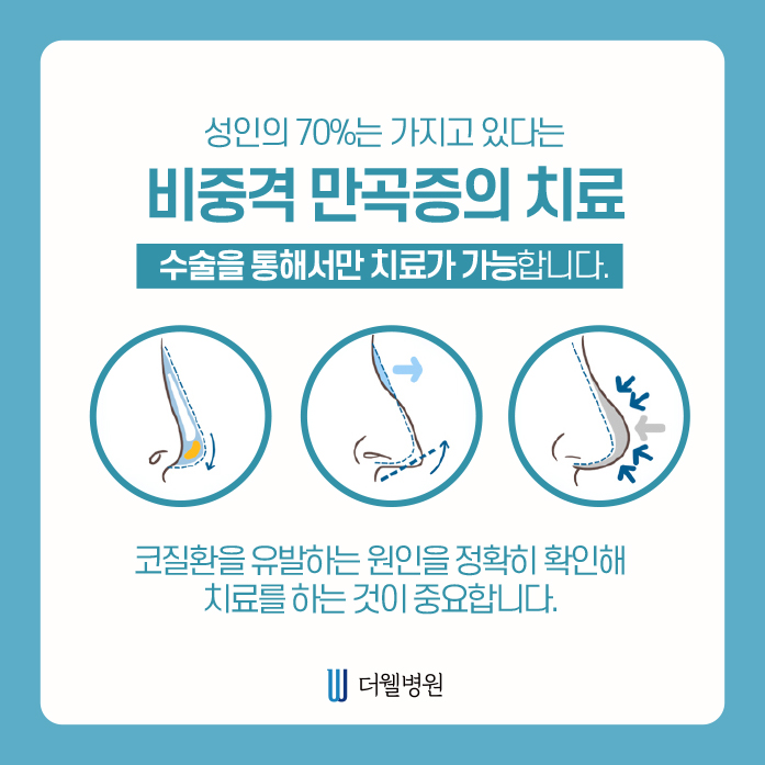 두통, 안면통의 원인 제대로 알아보기! (5/13)