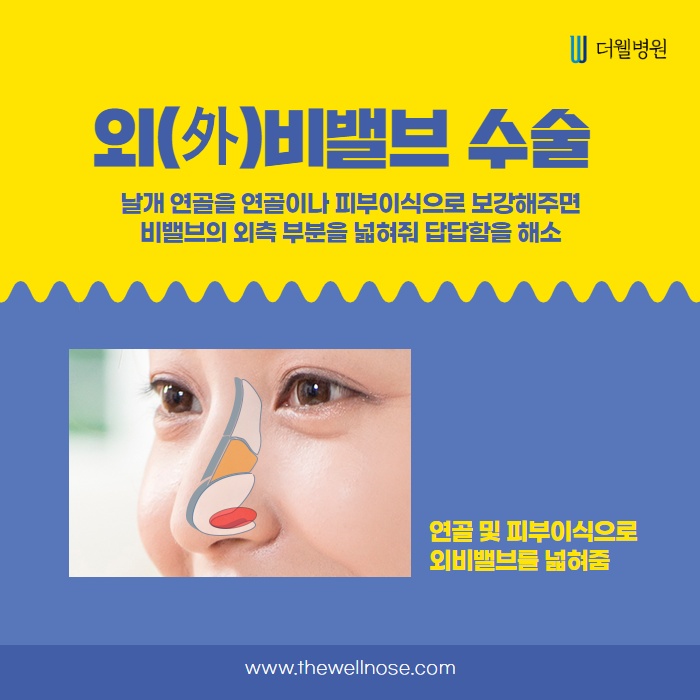 당신의 비밸브 상태는 어떤가요? (7/14)