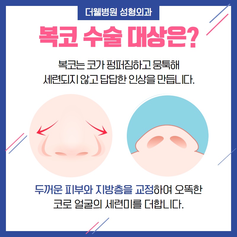답답하고 뭉툭한 코가 고민이라면? (2/9)