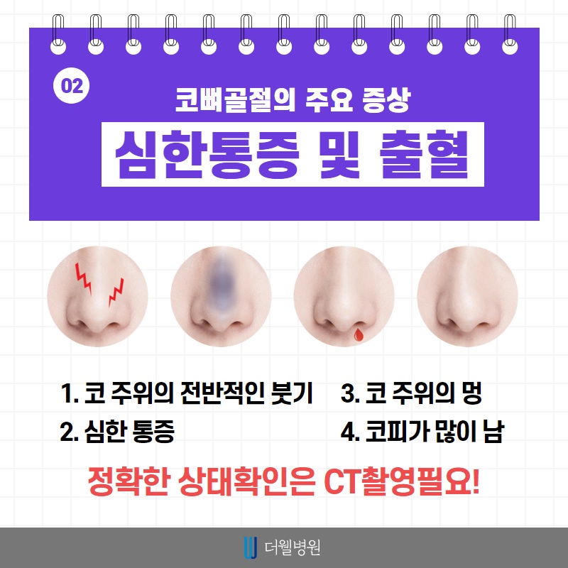 코 뼈 골절, 치료 시기가 중요합니다! (3/10)
