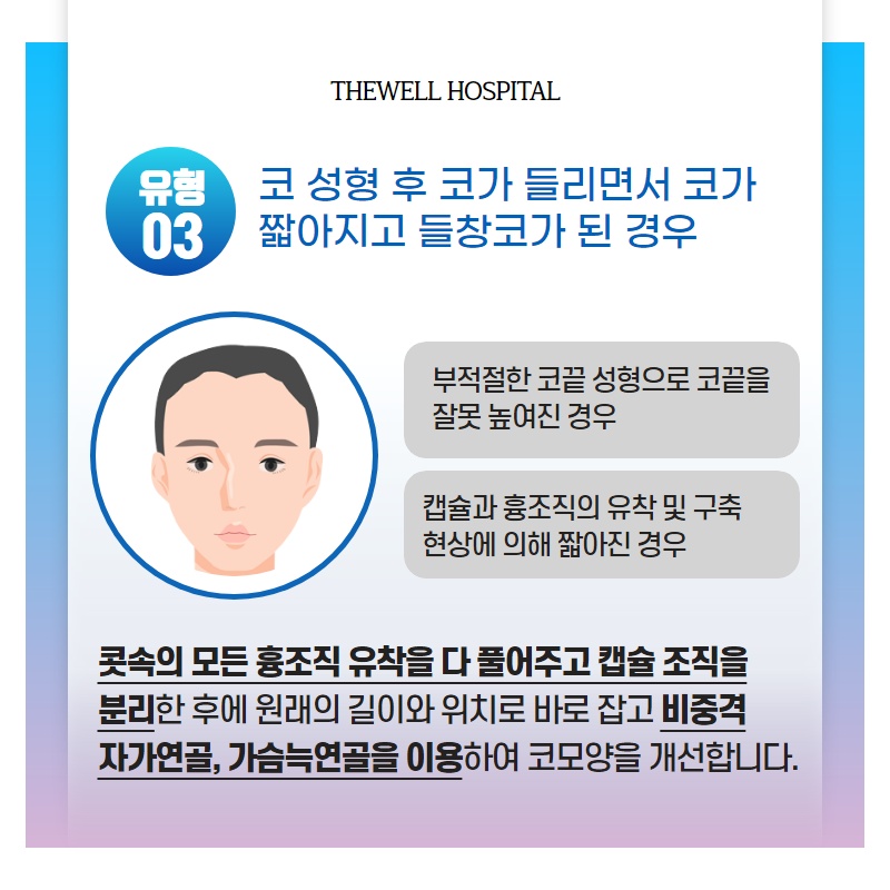 다양한 유형의 코 재수술, 더웰병원에서 하자! (5/10)