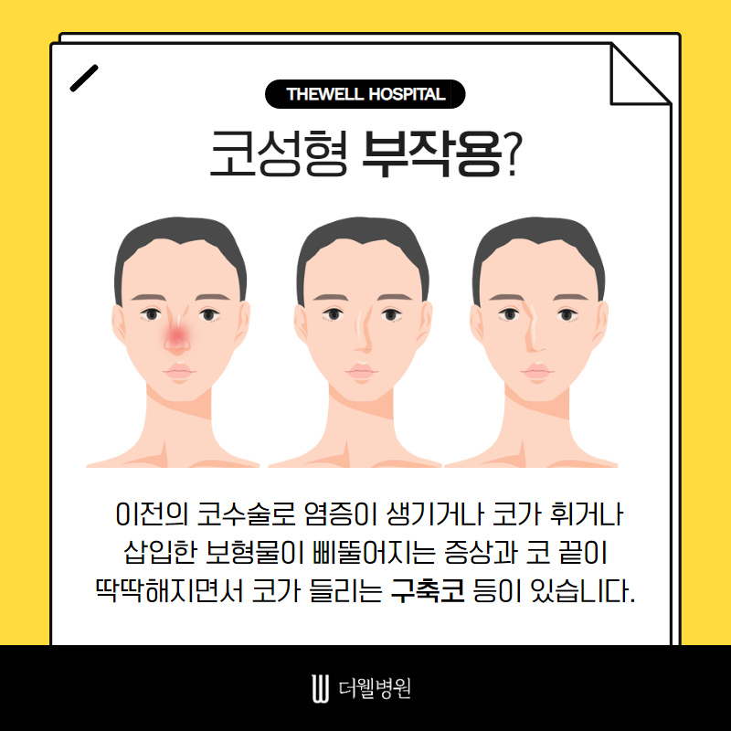 기능과 모양까지 고려한 여성 코재수술! (2/10)