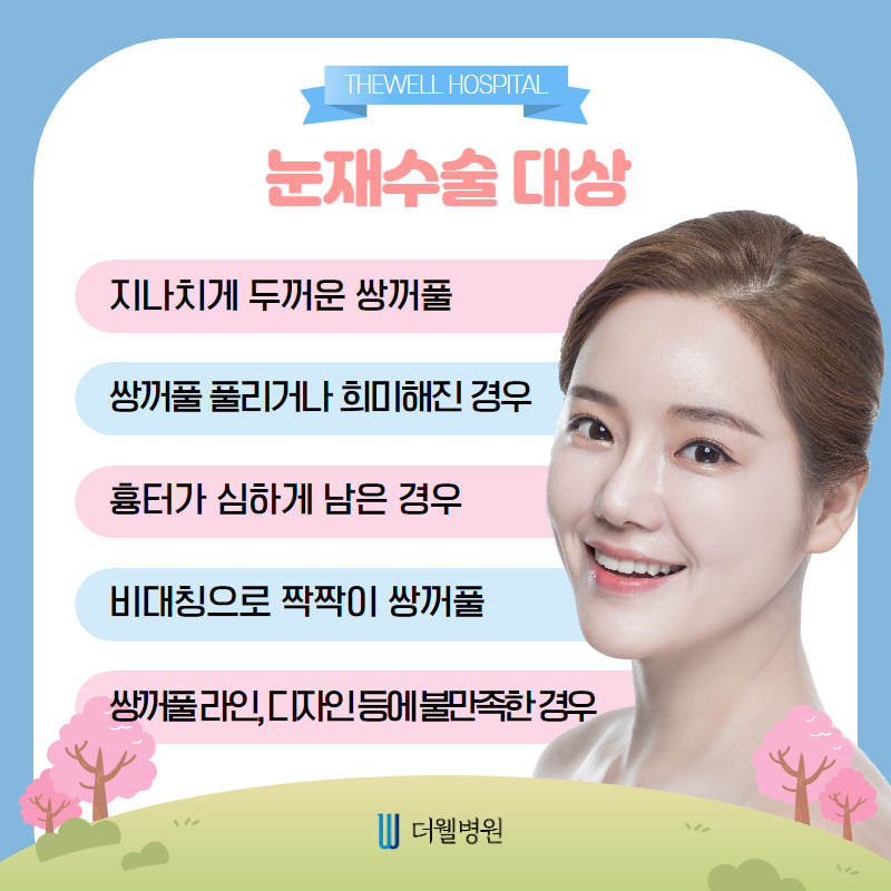 신중하게 결정하세요 "눈재수술"~ (3/10)