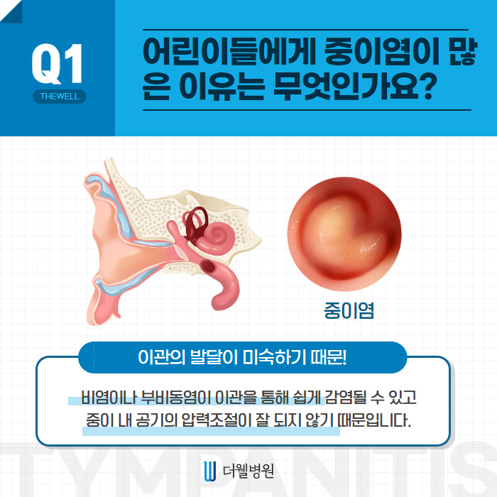 어린이 중이염 많이 발생하는 이유는? (2/10)