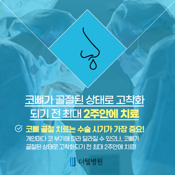 코 뼈 골절 빠른 시기에 치료해야합니다! (2/10)