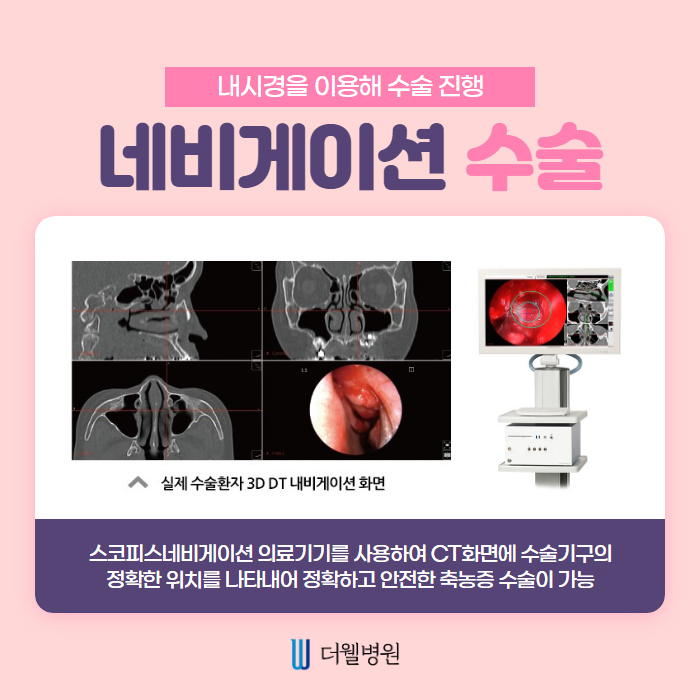 축농증(부비동염) 치료방법은?! (5/11)