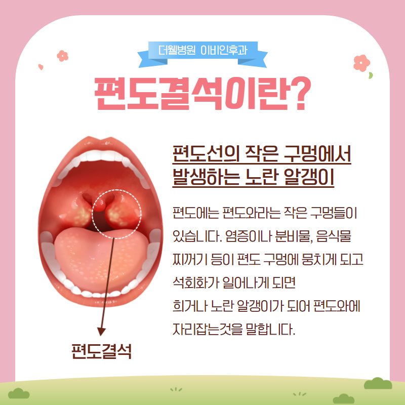 마스크 속 입냄새를 줄여주는 식품 4가지! (9/12)