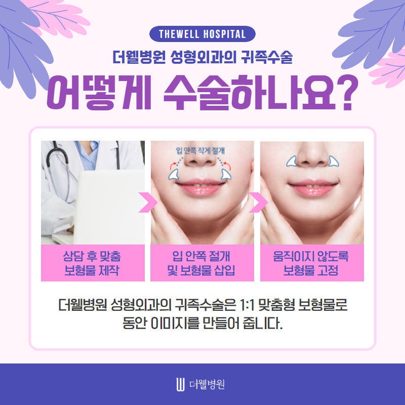 동안얼굴 원한다면 귀족수술 고고싱! (4/10)