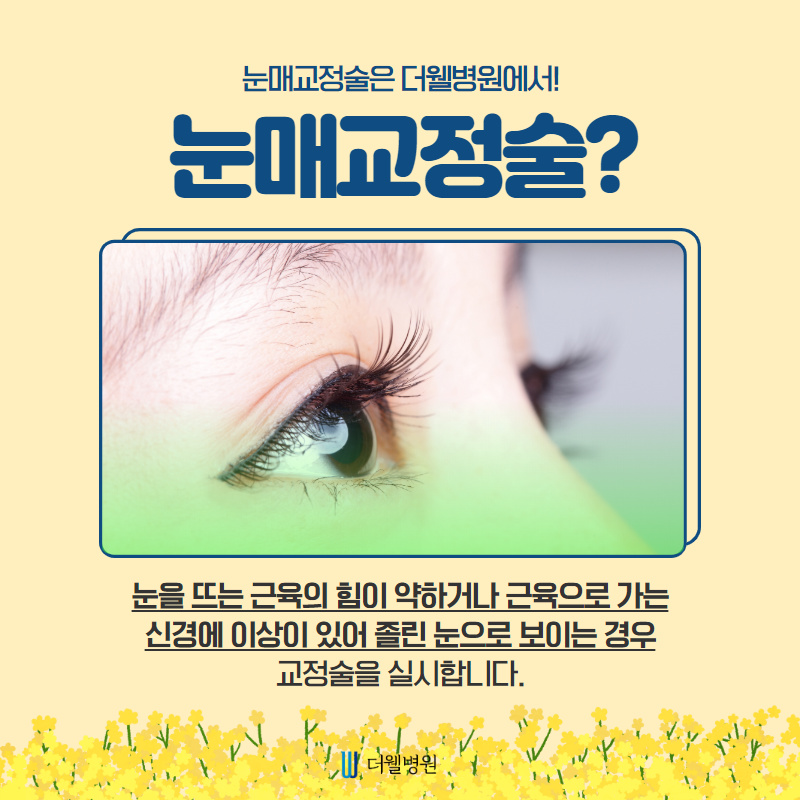 안검하수, 쌍꺼풀이 아닌 눈매교정으로 개선하세요! (2/10)