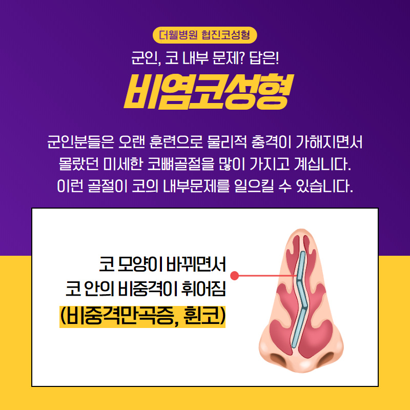 군인, 휴가중에 코성형 가능할까요?? (3/9)