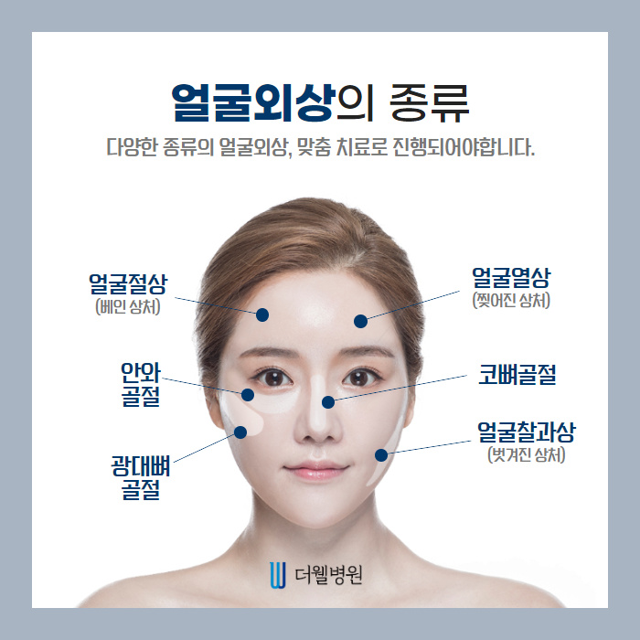 얼굴외상, 흉터가 남지 않으려면? (4/10)
