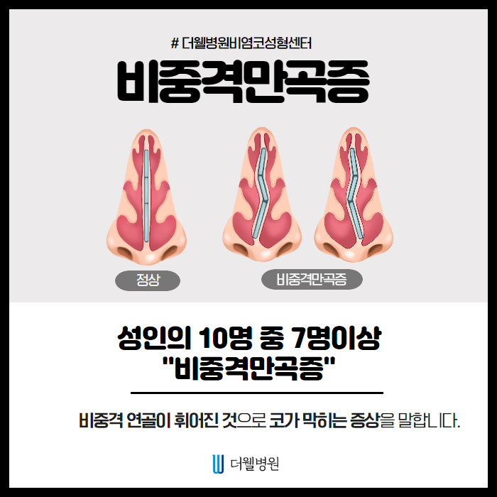 비중격만곡증을 무찌르러 왔다! (3/10)