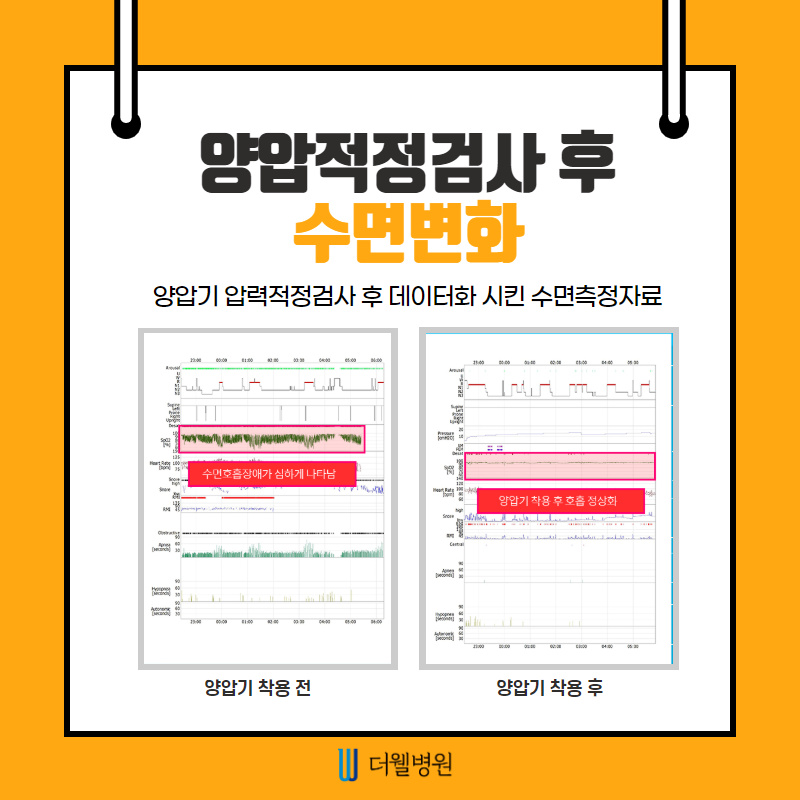 양압기, 평생 써야 하나요? (6/12)