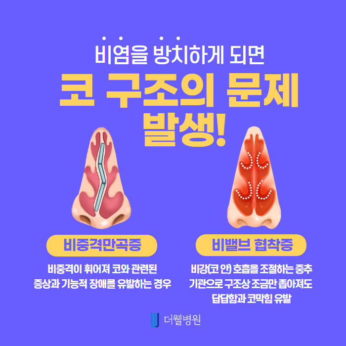 비염수술과 코성형을 한번에 한다고? (2/9)