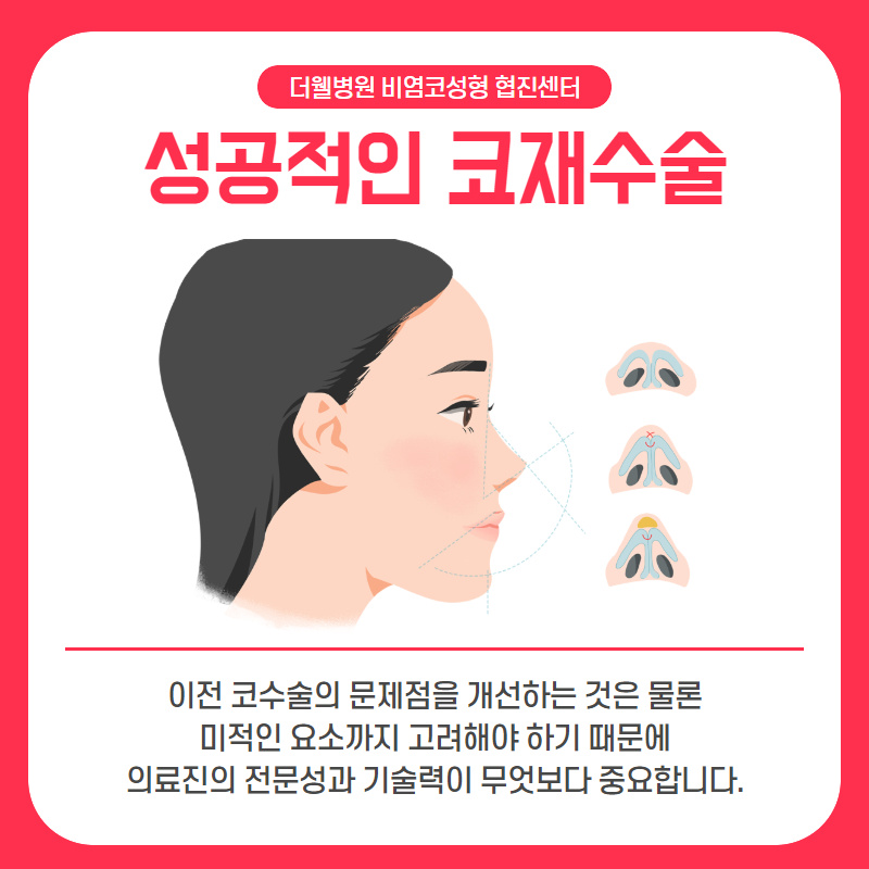 "코 재수술" 처음보다 더 꼼꼼하게 따져봐야해요! (5/10)