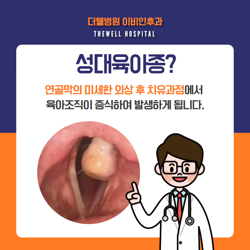 목 이물감, 통증?! 성대육아종 증상과 치료법! (2/10)