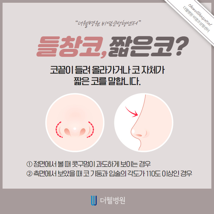 코가 짧은데 개선이 가능한가요? (2/9)