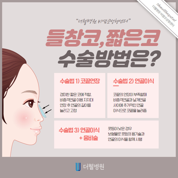 코가 짧은데 개선이 가능한가요? (3/9)