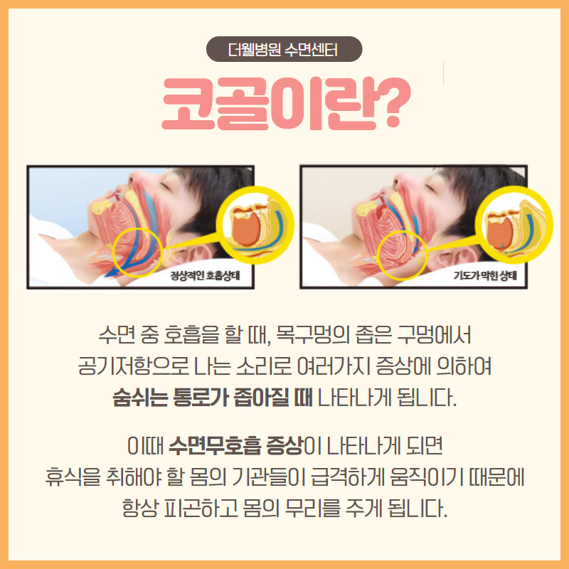 나와 우리 가족의 건강까지 위협하는 코골이! (3/10)