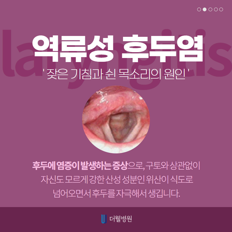 마른 기침의 원인은?! (2/10)