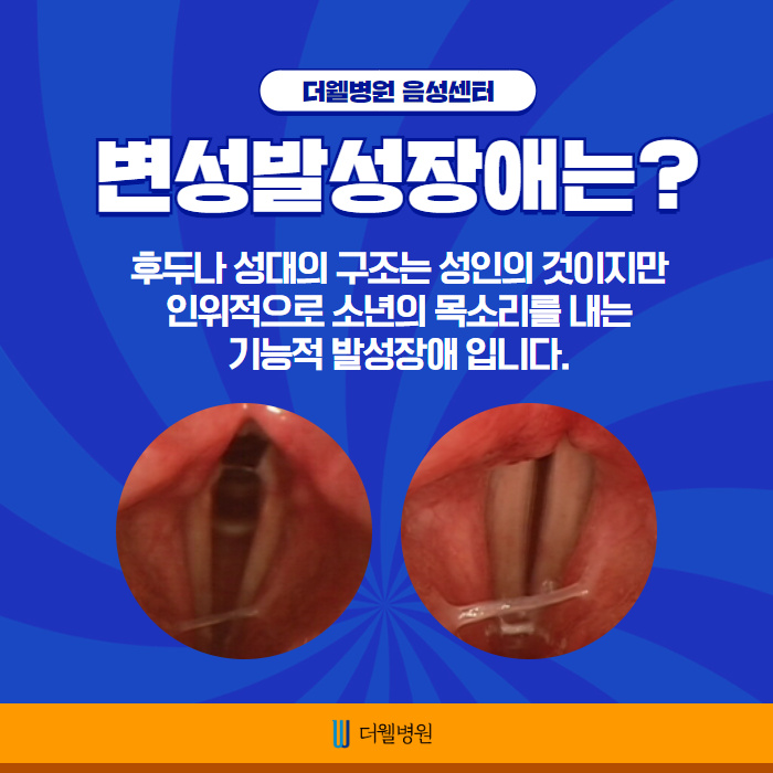 변성기? 변성발성장애! (2/10)