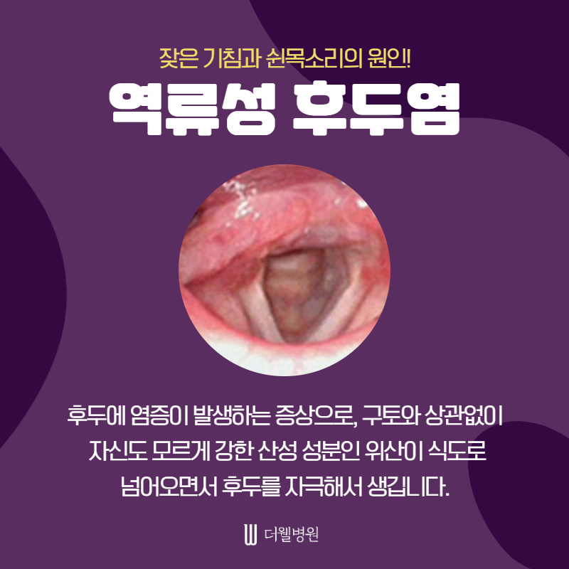 잦은 기침과 쉰목소리의 원인! 역류성 후두염 (2/10)