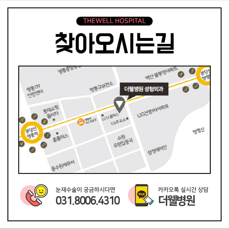 눈 재수술, 더 신중하게 결정하세요! (9/10)