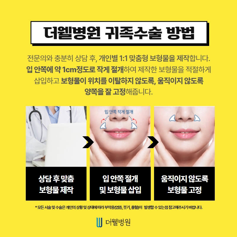 더웰병원 귀족수술