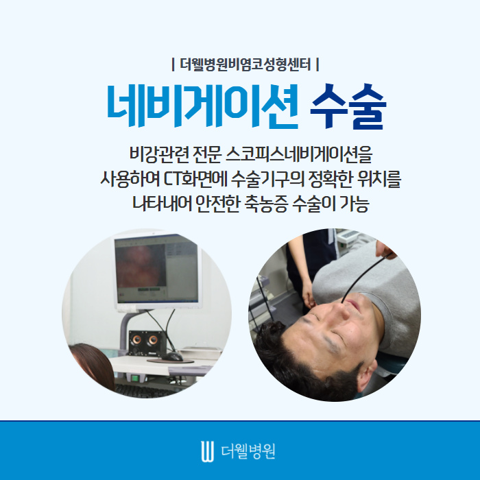 더웰병원 축농증(부비동염) 수술