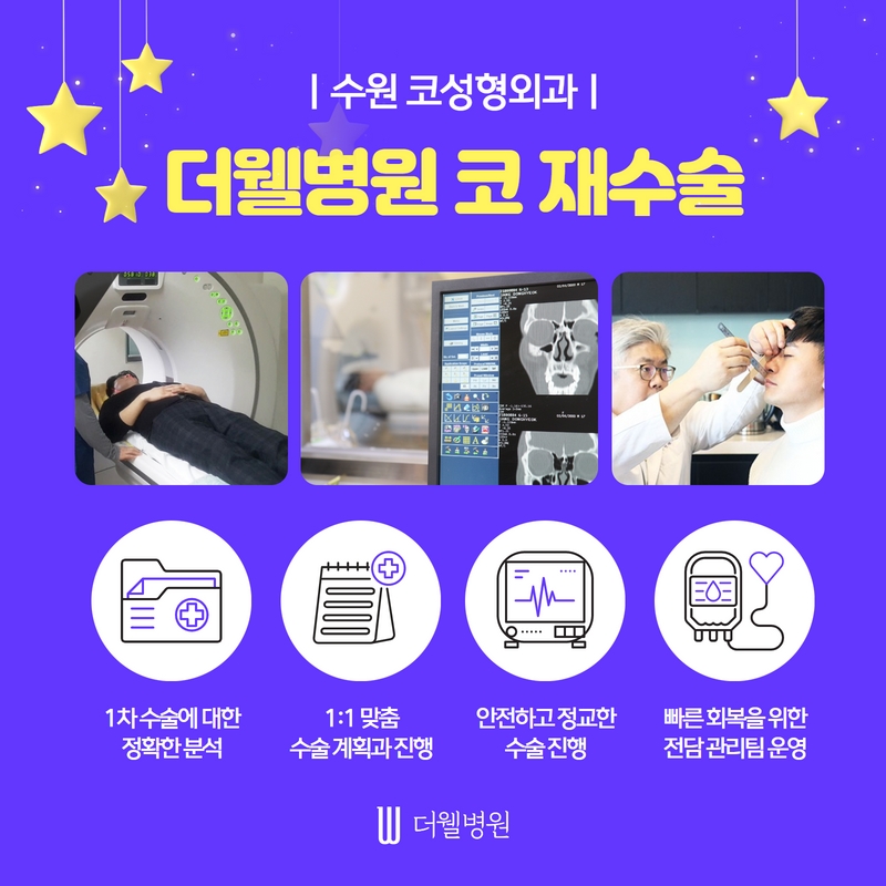 더웰병원 코 재수술