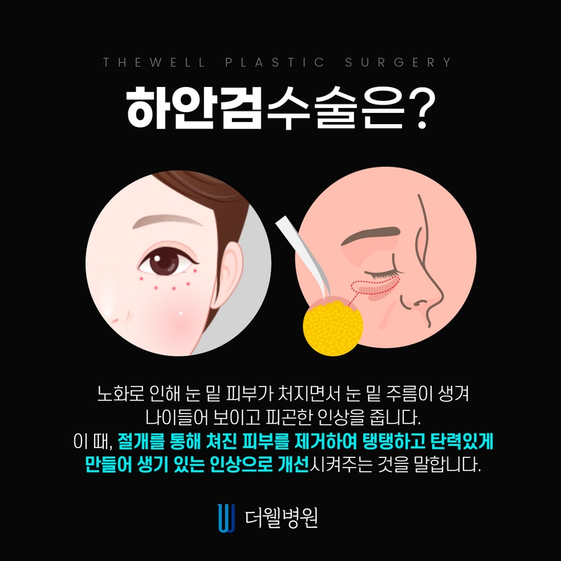 더웰병원 하안검 수술
