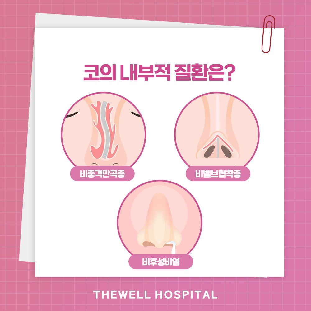 [수원 코성형] 기능코성형 주의할 점 총정리 (3/5)