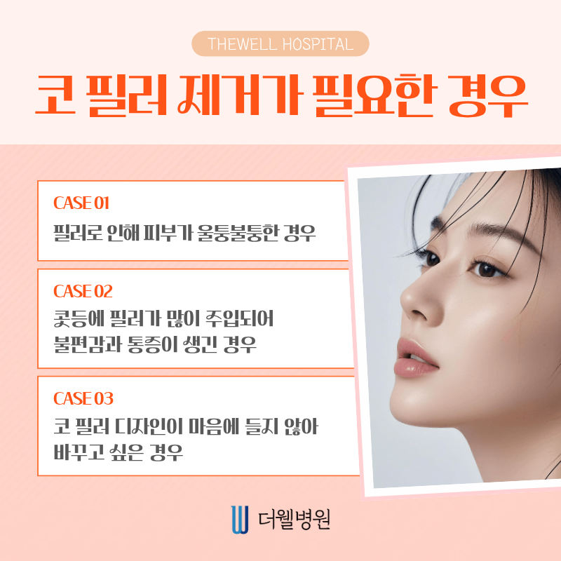 수원 성형외과 _ 코 필러 후 코 성형 가능할까? 안전한 시기와 방법 정리 (3/6)